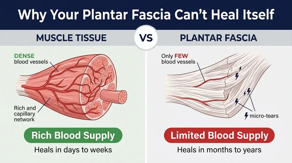 Why plantar fascia can't heal itself, muscle vs fascia blood supply