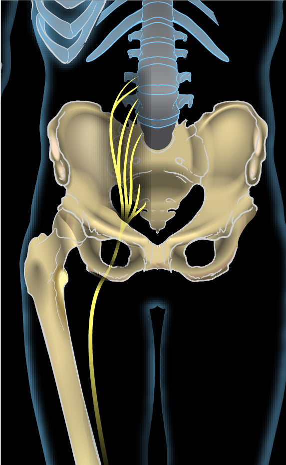Anatomical diagram of the sciatic nerve in the gluteal region